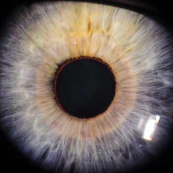 Iris Auge 5
